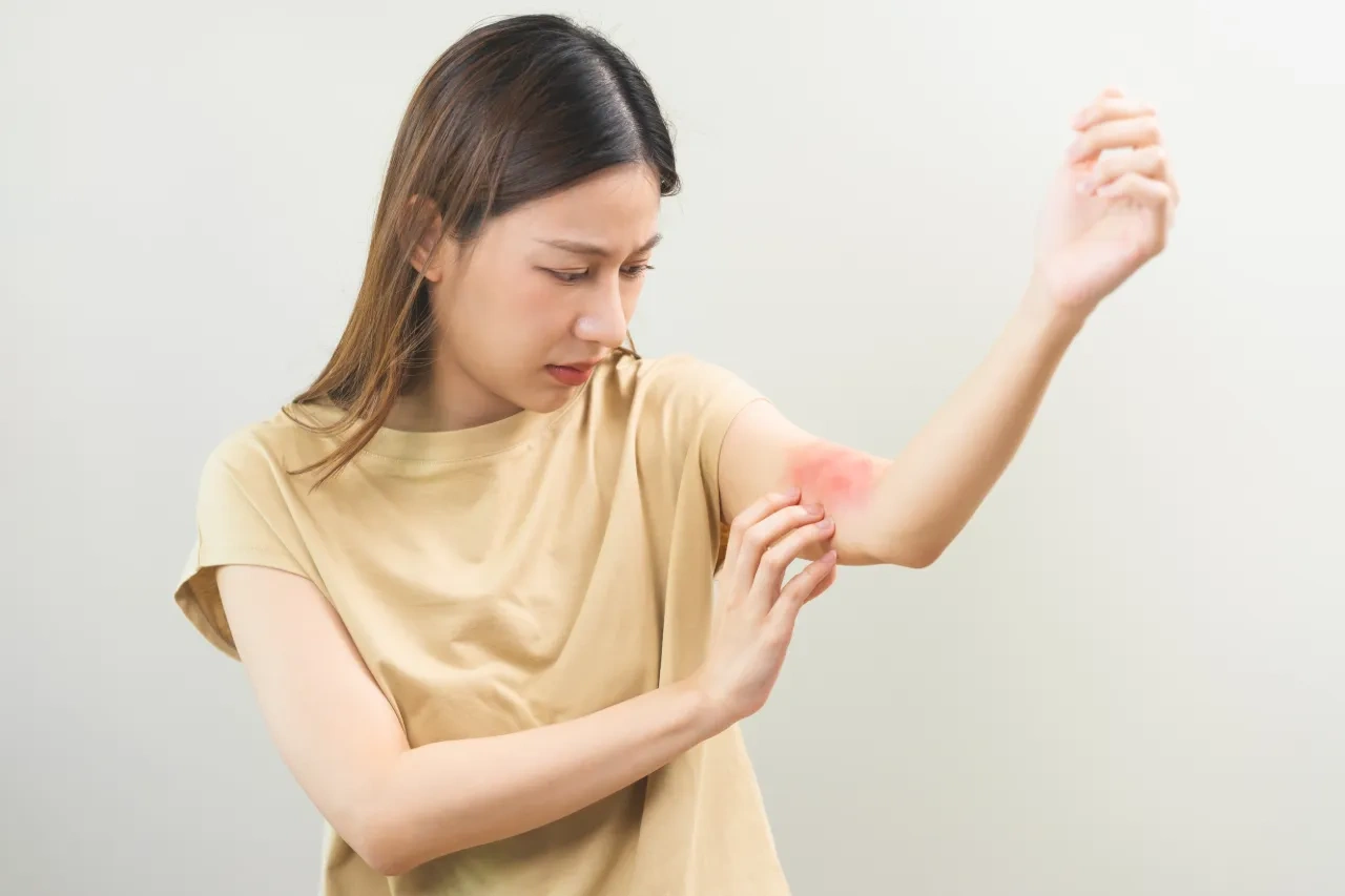 Woman scratching a red, irritated eczema rash on the inner elbow 