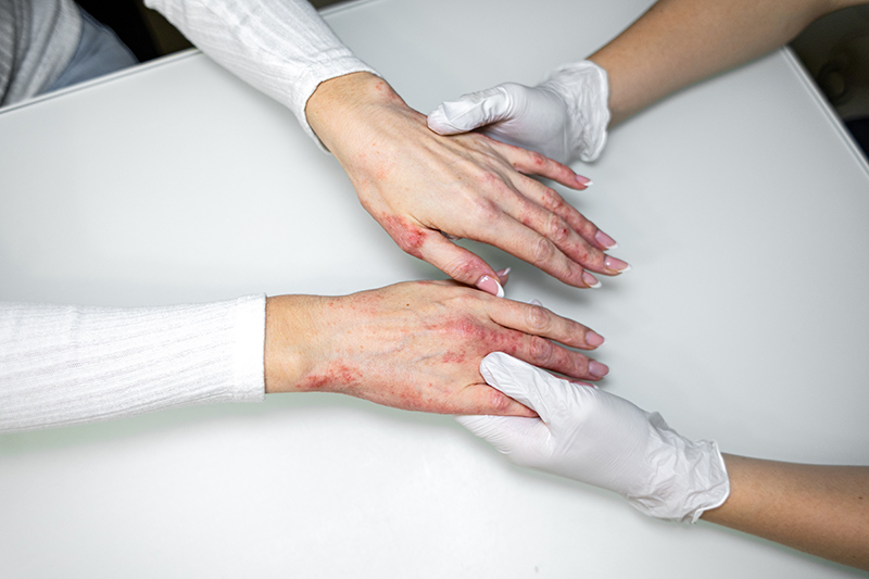 A dermatologist performing a skin examination.